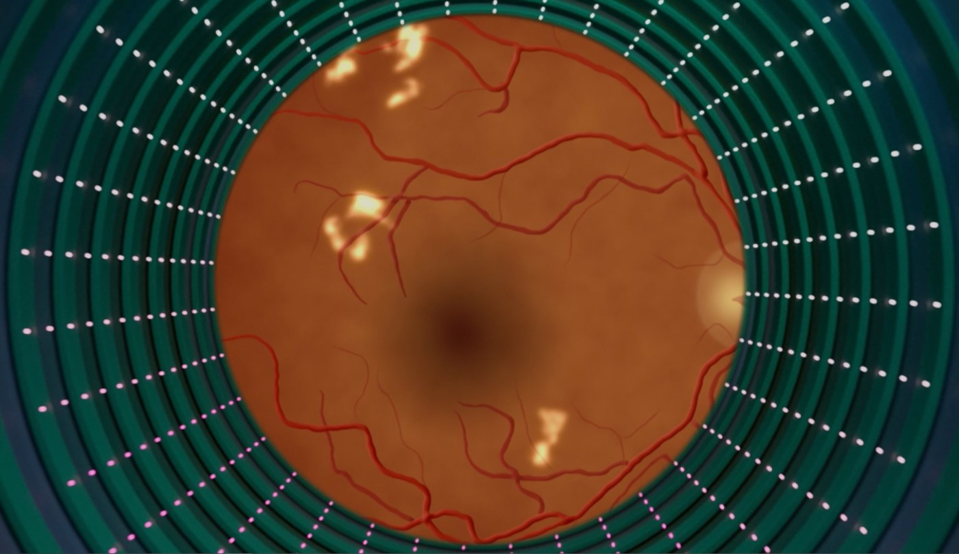 As AI eye exams prove their worth, lessons for future tech emerge 1 LIFE HEALTH AI EYE EXAMS 1 MCT UeCYGN