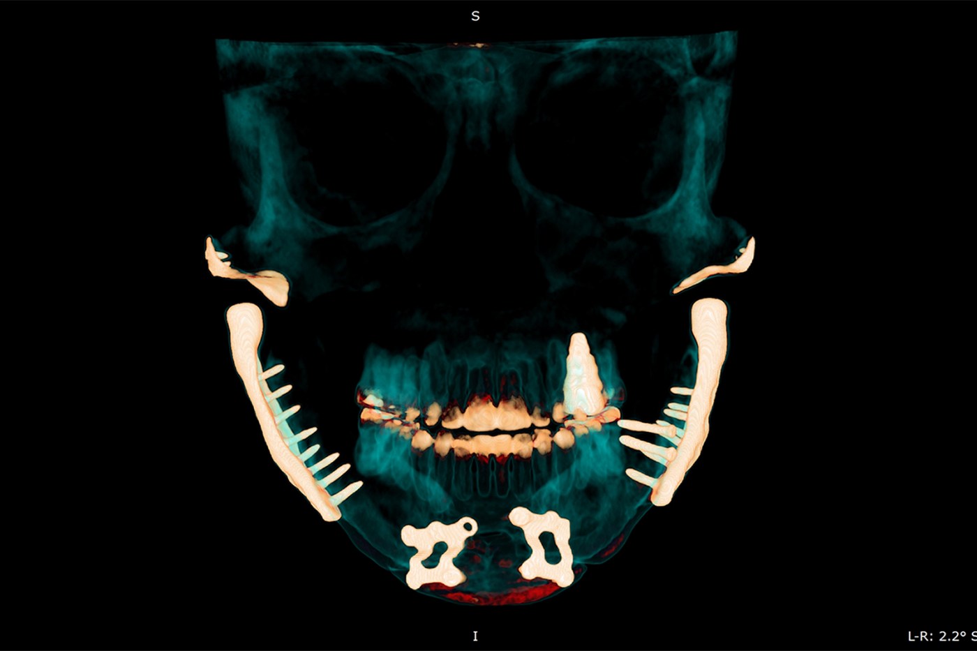 LIFE HEALTH TMJ MCT 7lSvzG