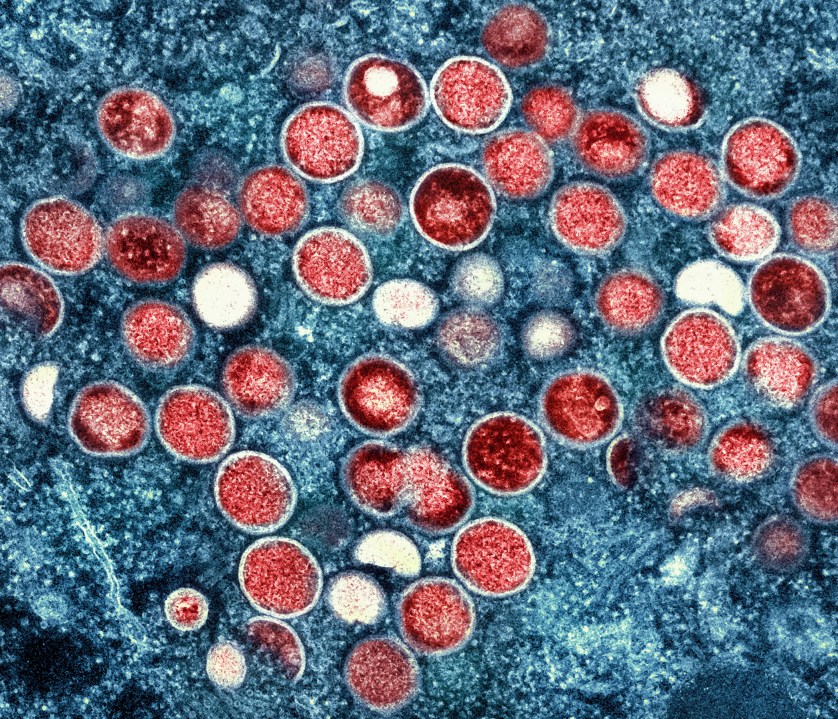 Mpox cases in L.A. County on the rise, Public Health warns 1 66bcf372692191.84098759 0Zu9Y7