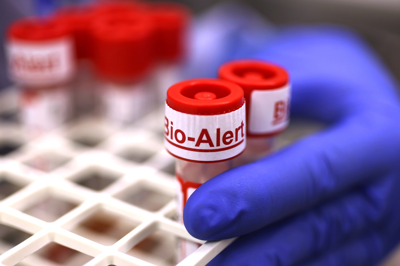 Health agencies scramble to prepare for new mpox strain 1 US NEWS MED MPOX GET 7cw6Iz