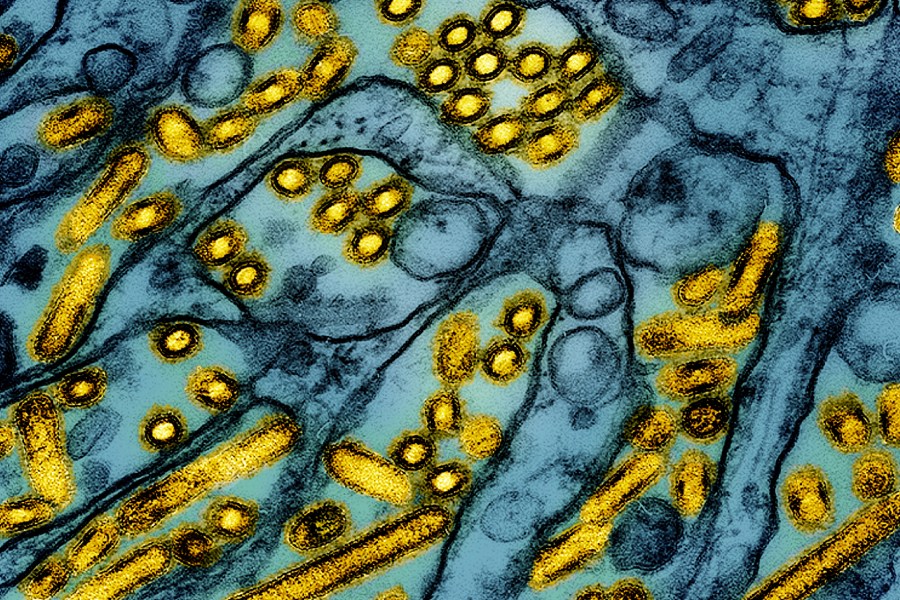 North Bay child tests positive for bird flu after drinking raw milk: officials 1 AP24312642041229 EAr0Zn