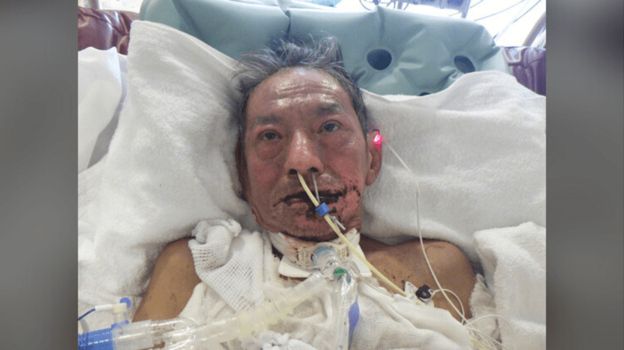 L.A. hospital needs help identifying injured man 2 pd 1 5 AW78IU